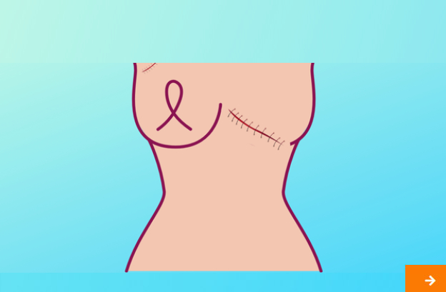 Scar Tissue Management Hypopresssives